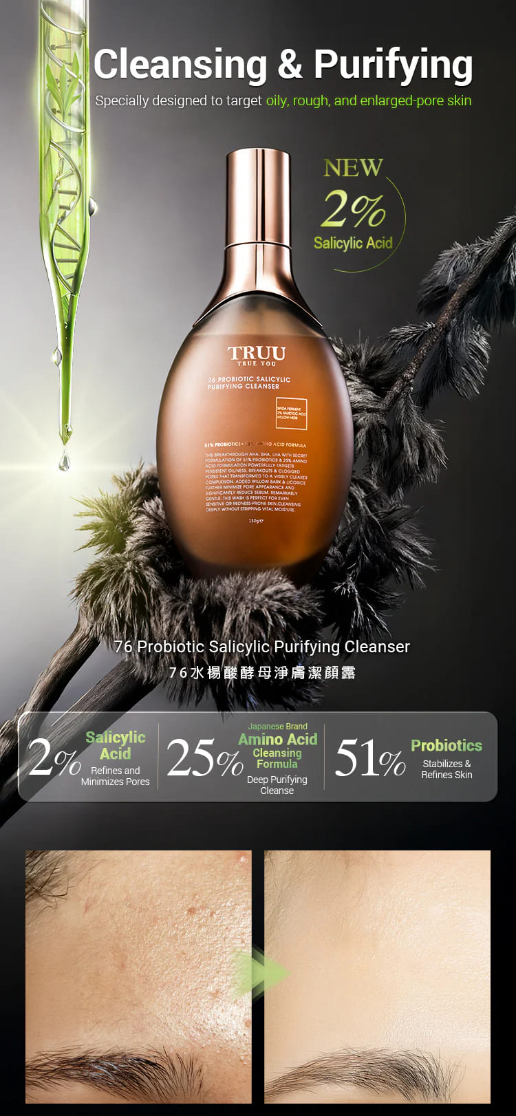 76 Probiotic Salicylic Purifying Cleanser+Six types of Essence