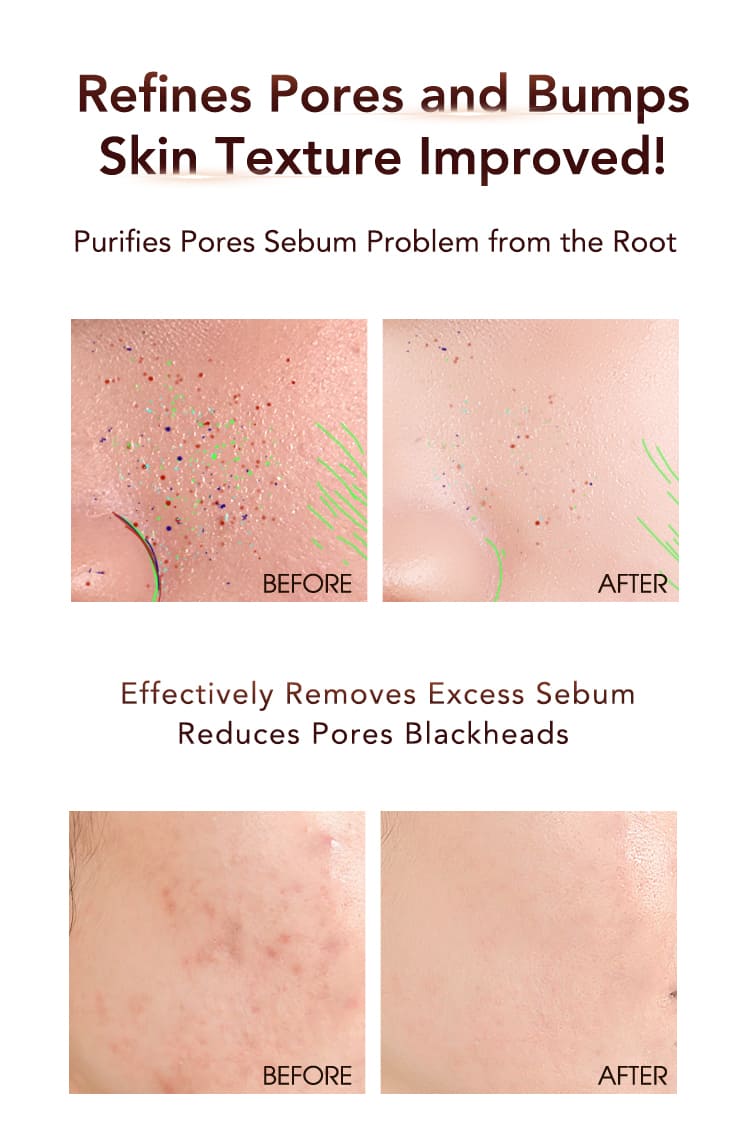 日本未発売☆TRUU 45 Pores Refining Essence 美容液 Amazon.com: TRUU